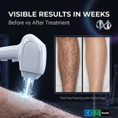 Mecavie 4000W 2-in-1 Diode Pico Laser Salon Hair & Tattoo Removal Machine